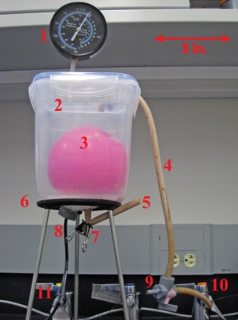 neurogenic Bladder