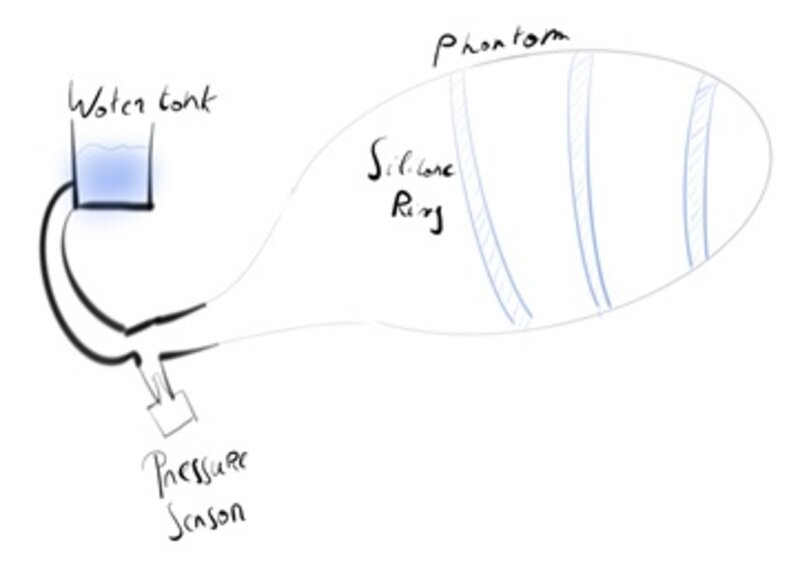 neurogenic Bladder