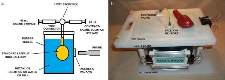 neurogenic Bladder