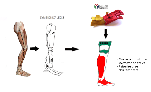 Legprosthesisidea